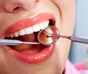 Why Does My Dental Filling Hurt?